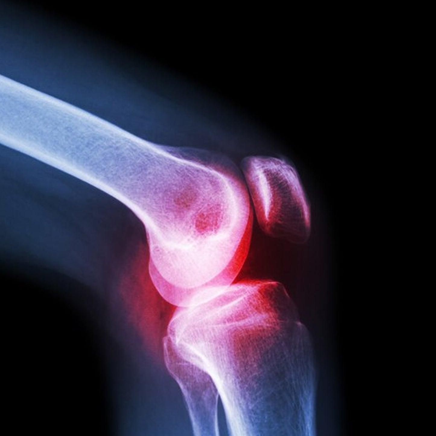 Knee Cap for Knee Support (Large)
